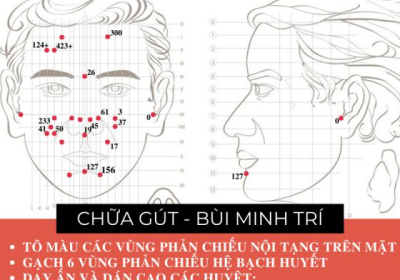 Dien Chan chua gout